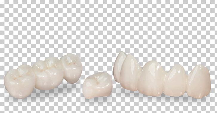 Family Dentistry Tooth Jewellery Health PNG, Clipart, 3 M, Body Jewellery, Body Jewelry, Ceramic, Crown Free PNG Download