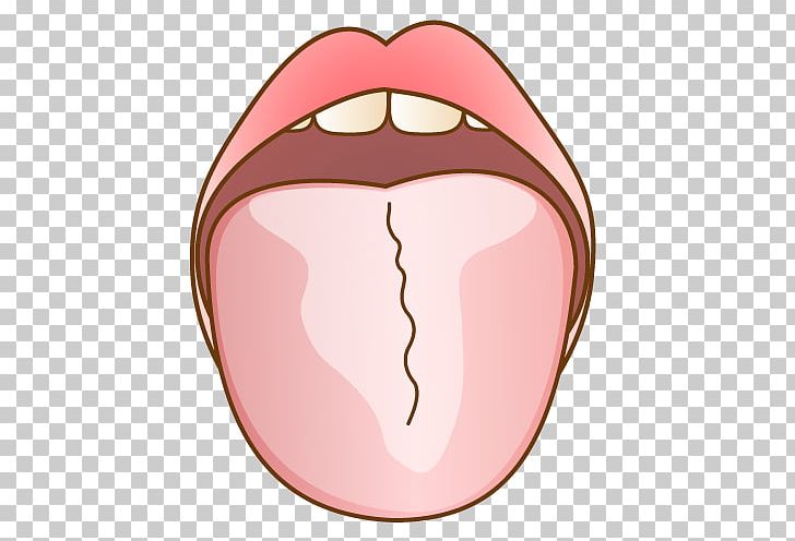 舌苔 Dentist Tongue 歯科 Tooth PNG, Clipart, Bad Breath, Cheek, Dental, Dental Braces, Dentist Free PNG Download