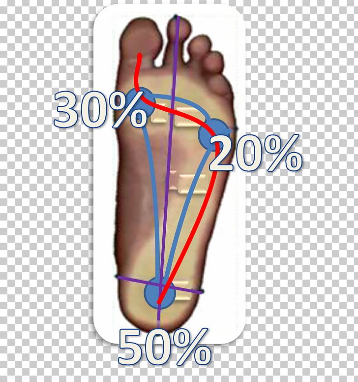 Thumb Esame Baropodometrico Foot Orthopaedics Metatarsal Bones PNG, Clipart, Arm, Esame Baropodometrico, Finger, Foot, Hand Free PNG Download