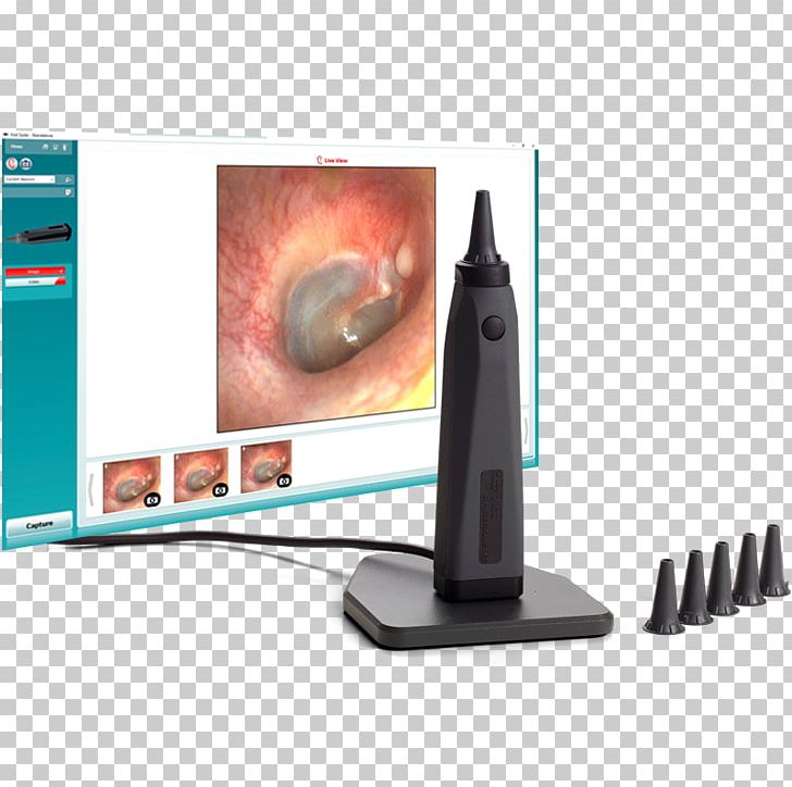 Otoscope Audiometry Computer Monitors Otoscopia Otoskopie PNG, Clipart, Ahsaudiology Hearing Solutions, Audiometry, Computer Monitor, Computer Monitor Accessory, Computer Monitors Free PNG Download