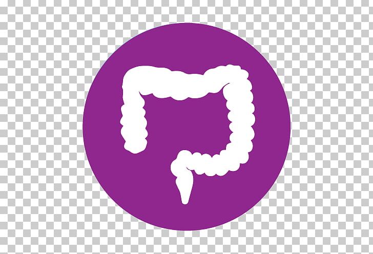 Crohn's Disease Large Intestine Therapy PNG, Clipart, Cancer Symbol, Circle, Colonoscopy, Colorectal Cancer, Crohns Disease Free PNG Download