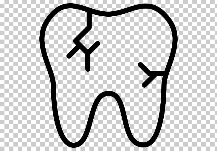 Стоматология Vinir Dentistry Human Tooth PNG, Clipart, Area, Black And White, Bone Fracture, Computer Icons, Cracked Tooth Syndrome Free PNG Download