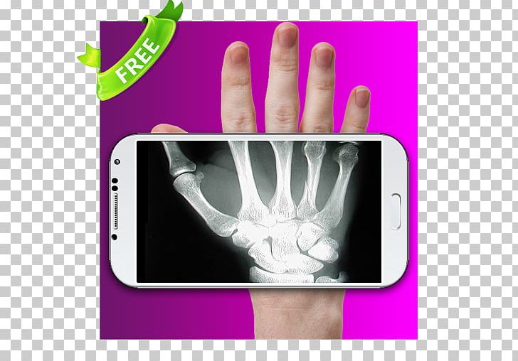 Thumb Hand Model PNG, Clipart, Finger, Gadget, Hand, Hand Model, Nail Free PNG Download