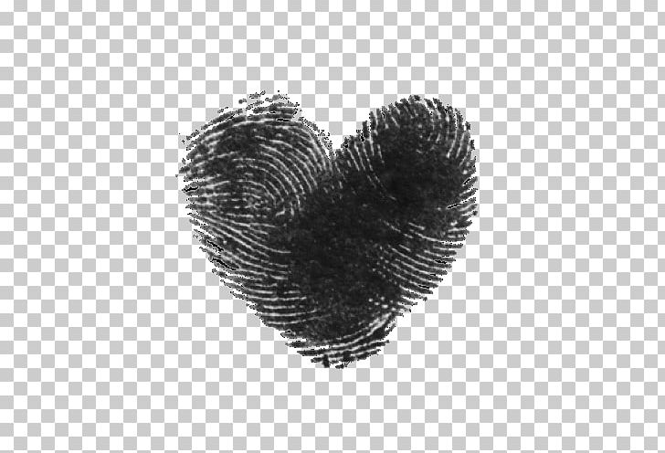 Congenital Heart Defect Drawing White PNG, Clipart, Black And White, Color, Congenital Heart Defect, Desktop Wallpaper, Doodle Free PNG Download