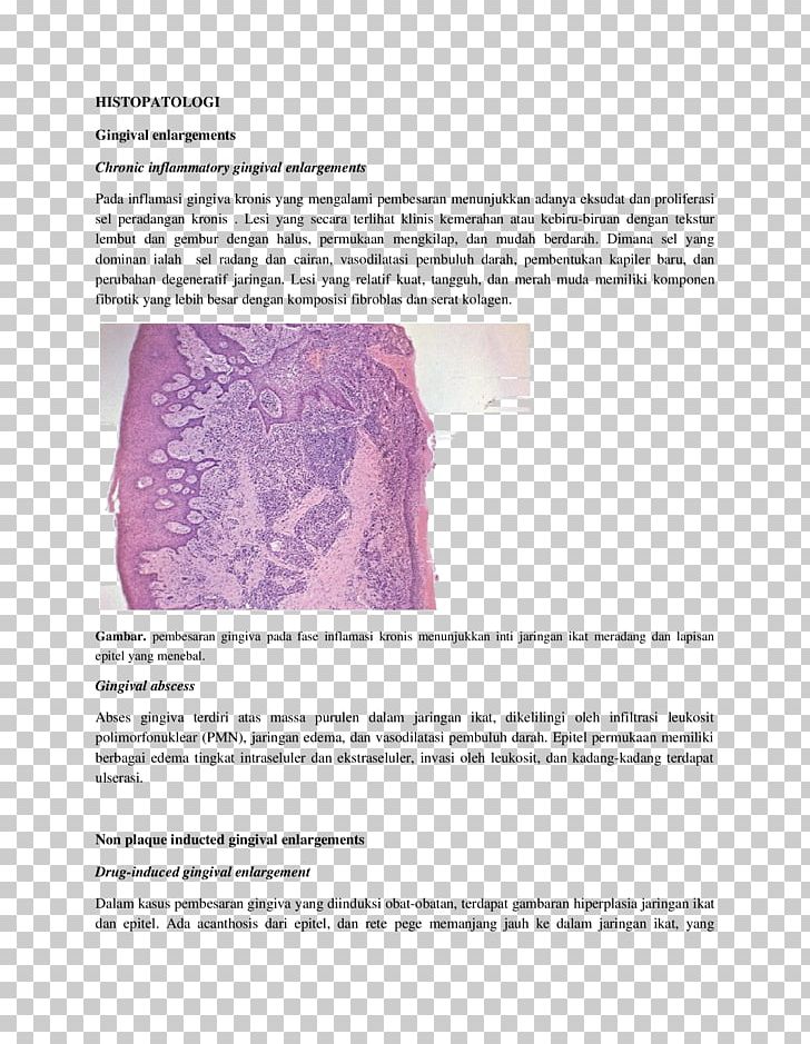 Inflammation Proliferasi Exudate Histopathology Cell PNG, Clipart, Cell, Chronic Condition, Clinical Psychology, Exudate, Gums Free PNG Download