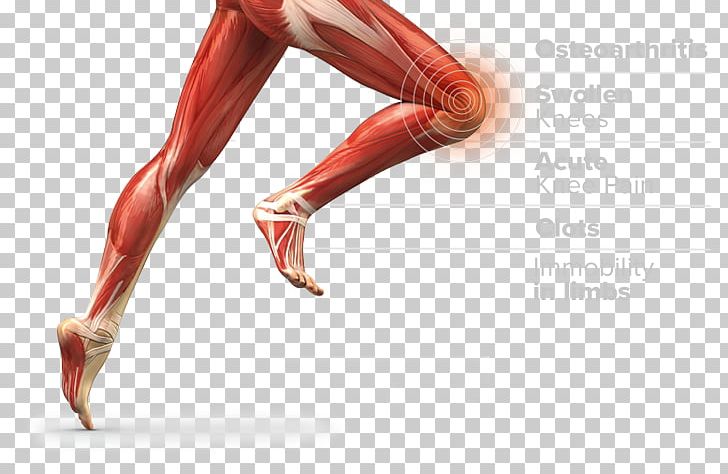 Thigh Muscle Muscular System Anatomy Human Body PNG, Clipart, Abdomen, Abdominal External Oblique Muscle, Acute, Anatomy, Arm Free PNG Download