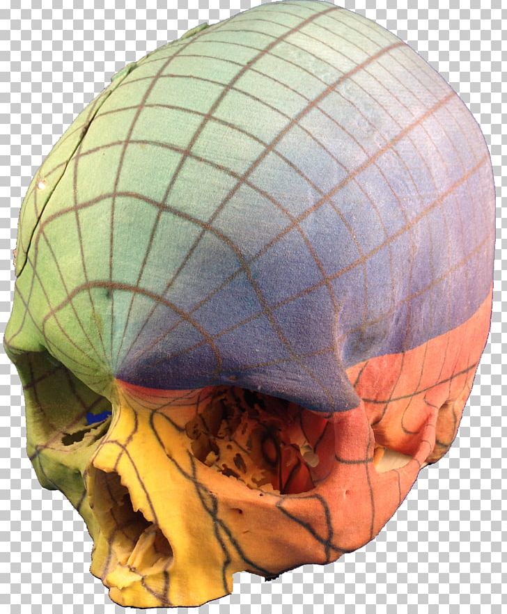 Anatomy 3D Printing Jaw Skull PNG, Clipart, 3 D, 3 D Printer, 3d Computer Graphics, 3d Printing, Anatomy Free PNG Download