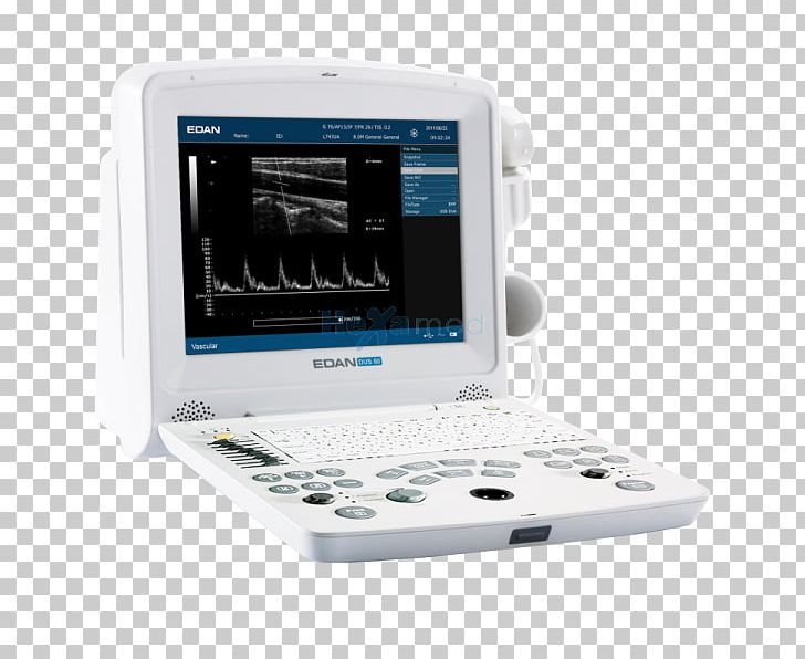 Ultrasound Ultrasonography Ecógrafo Medical Imaging Medical Equipment PNG, Clipart, Cardiology, Diagnostic Ultrasound, Display Device, Electronics, Medical Free PNG Download