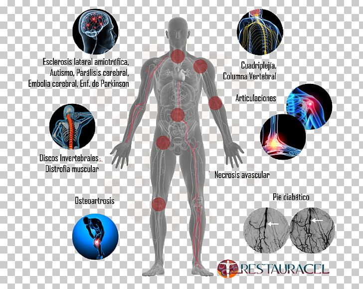 Stem Cell Stem-cell Therapy Human Body PNG, Clipart, Abdomen, Arm, Astrocyte, Cell, Cell Therapy Free PNG Download