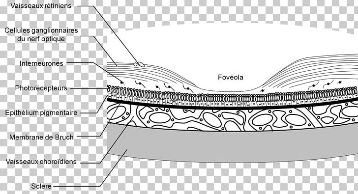 Choroid Uveal Melanoma Retina Human Eye PNG, Clipart,  Free PNG Download