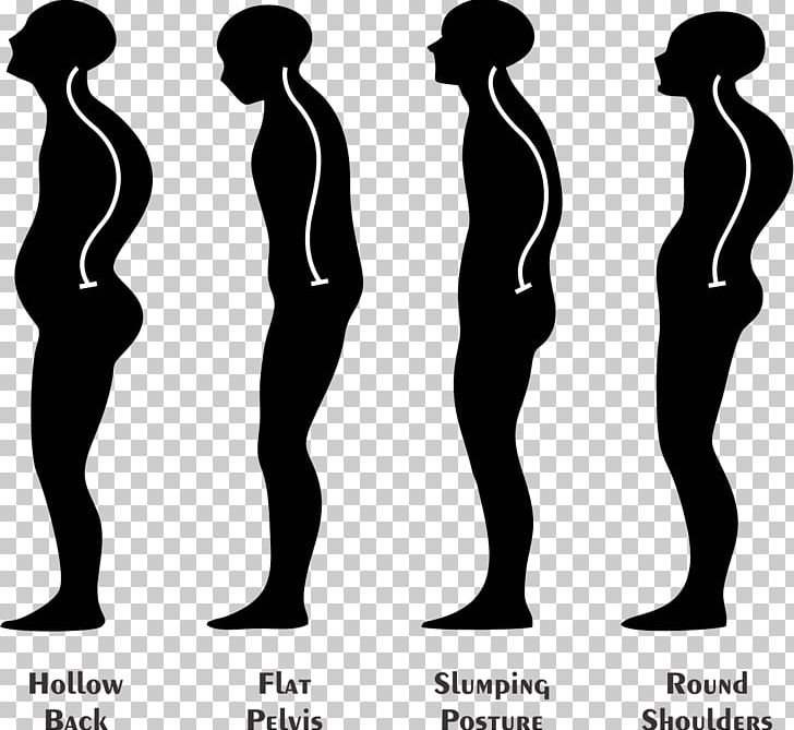 Neutral Spine Poor Posture Physical Therapy Human Body PNG, Clipart, Arm, Black And White, Chiropractic, Hand, Hip Free PNG Download