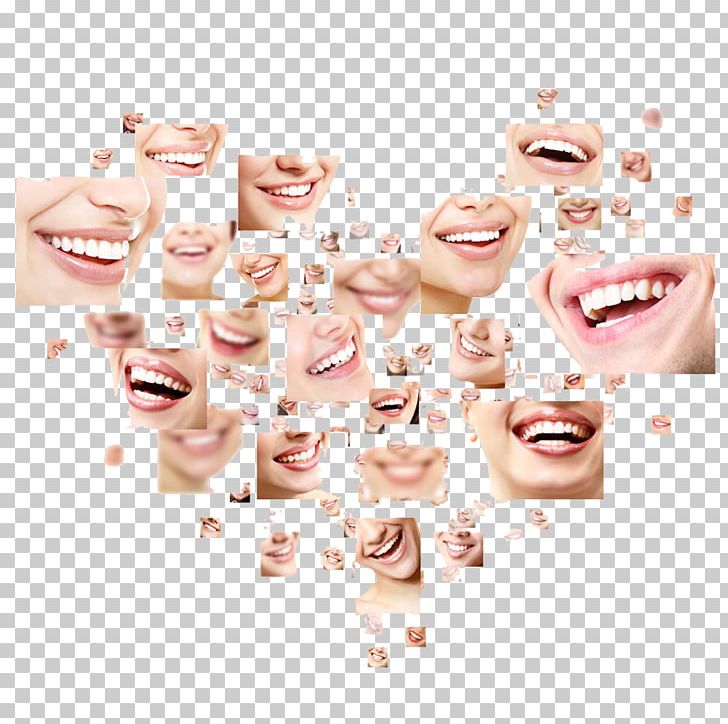 Dentistry Human Tooth Health Smile PNG, Clipart, Cheek, Chin, Cosmetic Dentistry, Dental Braces, Dental Implant Free PNG Download