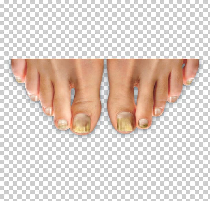 Nail Manicure Hand Model Toe PNG, Clipart, Finger, Foot, Hand, Hand Model, Leg Free PNG Download