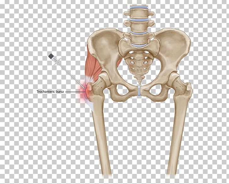 Greater Trochanteric Pain Syndrome Low Back Pain Vertebral Column Muscle Pelvis PNG, Clipart, Ache, Angle, Back Pain, Bone, Greater Trochanter Free PNG Download