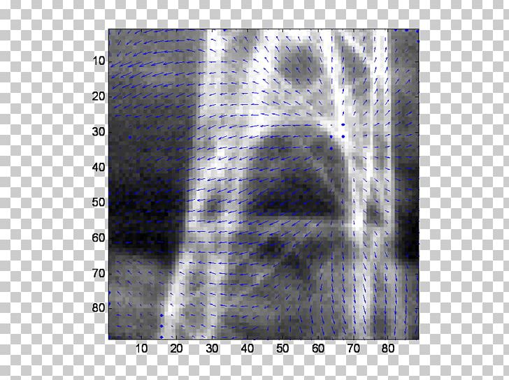 X-ray Radiology Lääketieteellinen Röntgenkuvaus Radiography Angle PNG, Clipart, Angle, Medical, Medical Radiography, Passive Infrared Sensor, Radiography Free PNG Download
