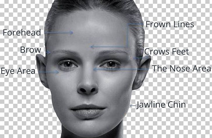 Forehead Wrinkle Cheek Skin Element Clinic Face PNG, Clipart, Antiaging Cream, Black And White, Cheek, Chin, Cosmetics Free PNG Download