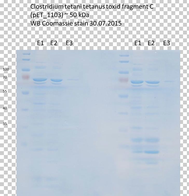 Screenshot Water Line Sky Plc PNG, Clipart, Blue, Clostridium Tetani, Diagram, Document, Line Free PNG Download