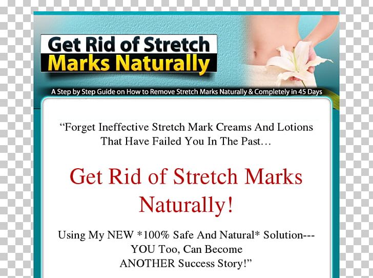 Stretch Marks Web Page PNG, Clipart, Advertising, Banner, Brand, Document, Line Free PNG Download