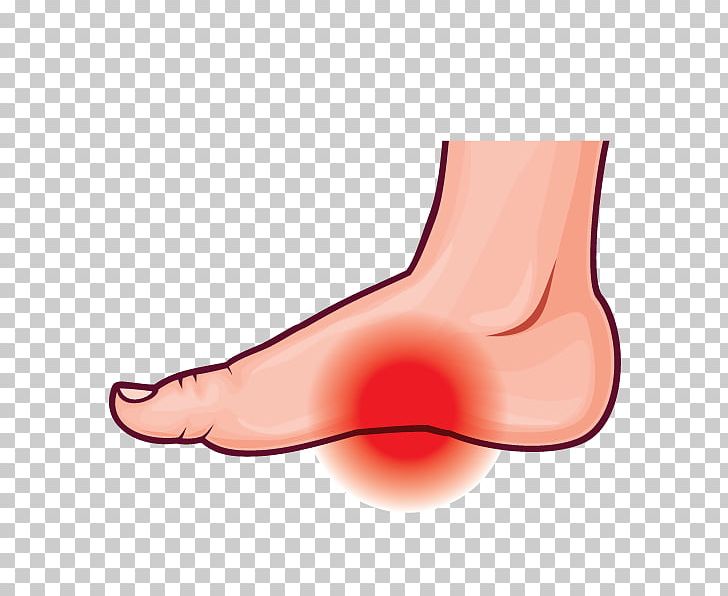 Thumb Arches Of The Foot Podalgia Plantar Fasciitis PNG, Clipart, Abdomen, Ankle, Arche, Arm, Diseases Of The Foot Free PNG Download