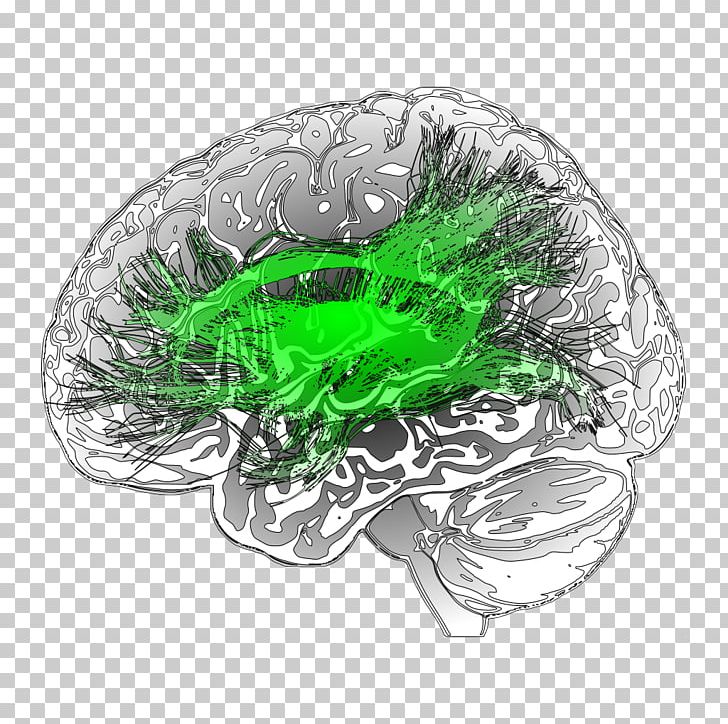 Leaf Medical Imaging Voxel Diagnostic Neuroradiology PNG, Clipart, Brain Department, Flower, Green, Leaf, Magnetic Resonance Imaging Free PNG Download