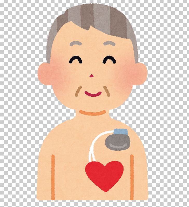 Artificial Cardiac Pacemaker Implantable Cardioverter-defibrillator Patient Heart Therapy PNG, Clipart,  Free PNG Download