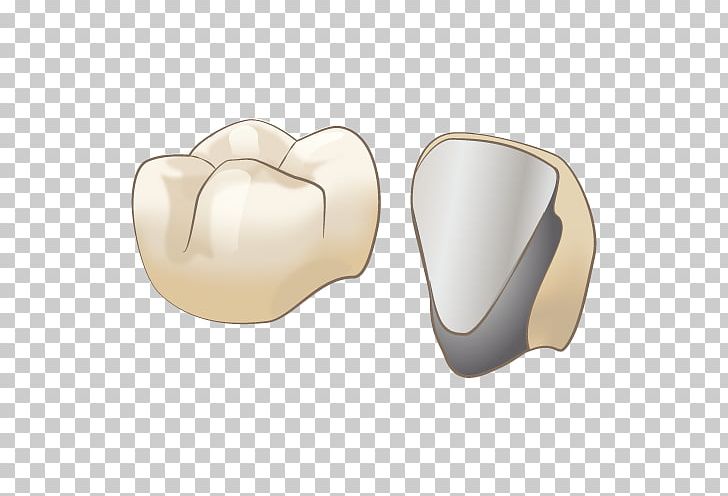 審美歯科 Dentist オールセラミック Therapy PNG, Clipart, Angle, Bruxism, Dentist, Others, Therapy Free PNG Download