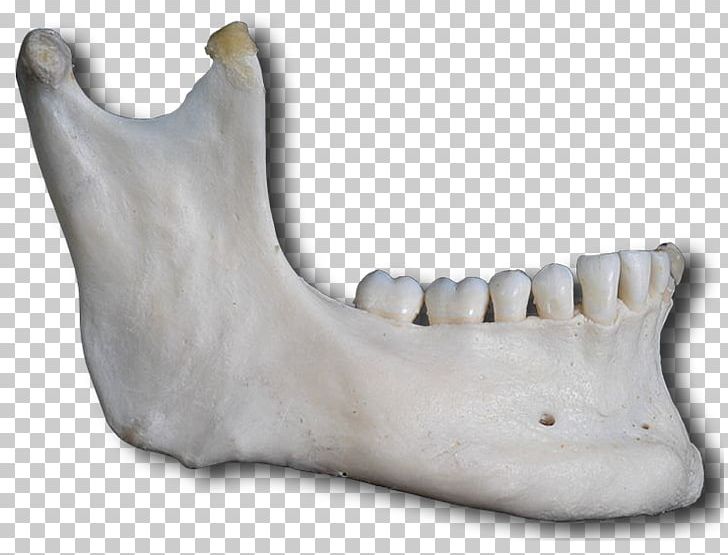 Jaw Mandible Facial Skeleton Bone Anatomy PNG, Clipart, Anatomy, Axial Skeleton, Bone, Face, Facial Skeleton Free PNG Download