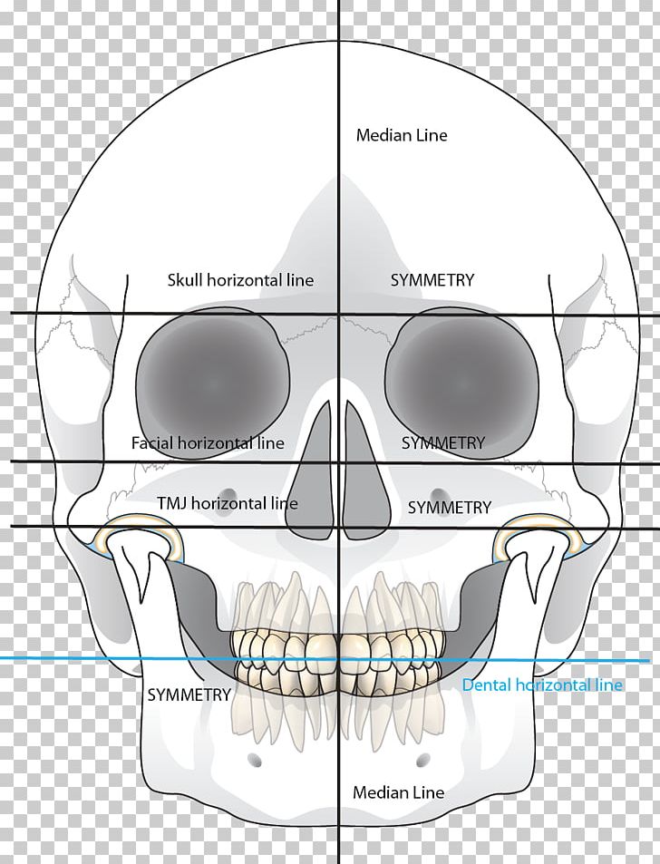 Bone Jaw Mouth PNG, Clipart, Angle, Area, Bone, Diagram, Electronics Free PNG Download