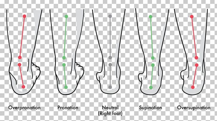 Pronation Of The Foot Supination Gait Achilles Tendinitis PNG, Clipart, Achilles Tendinitis, Achilles Tendon, Biomechanics, Flat Feet, Foot Free PNG Download