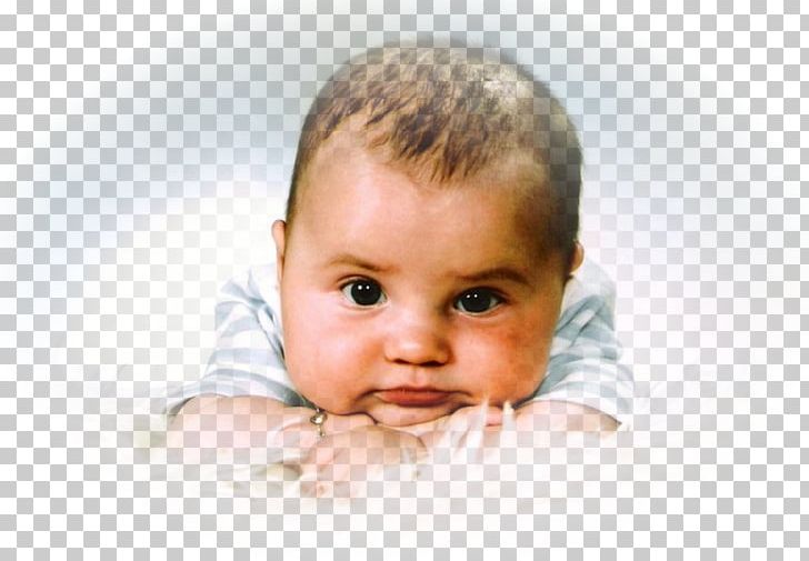Child Мой сынок Anzhero-Sudzhenskaya Gorodskaya Bol'nitsa Hydrocephalus Infant PNG, Clipart,  Free PNG Download