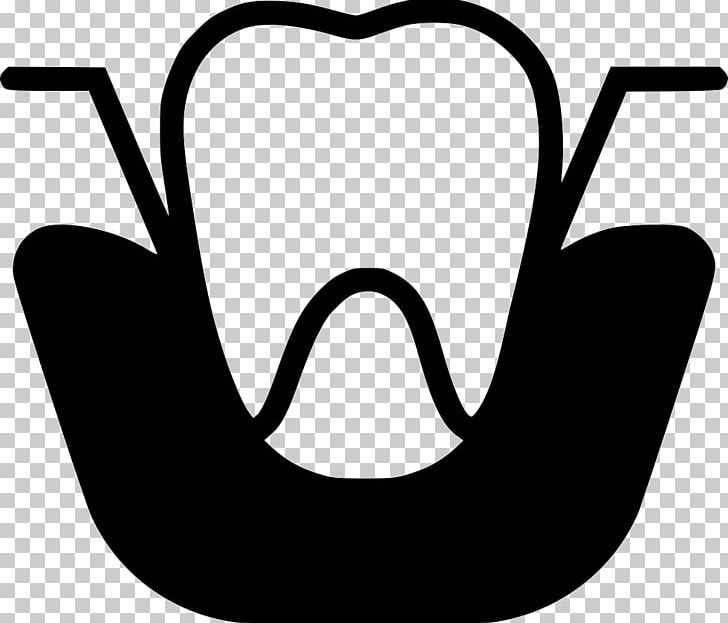 Dentistry Dental Extraction PNG, Clipart, Artwork, Black, Black And White, Computer Icons, Dental Extraction Free PNG Download