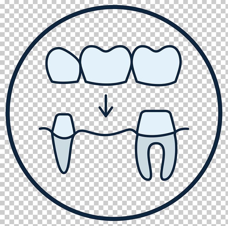 Tooth Dentist Crown Dentures Streeter Dental PNG, Clipart, Angle, Bridge, Circle, Crown, Dental Free PNG Download