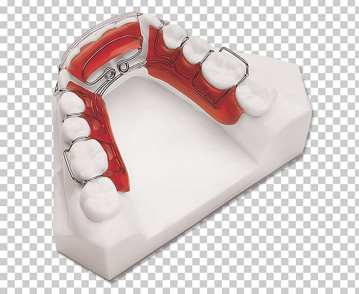 Retainer Orthodontics Mandible Dentistry Algún Lugar Profundo PNG, Clipart, Adviser, Dentistry, Hardware, Heart, Investopedia Free PNG Download