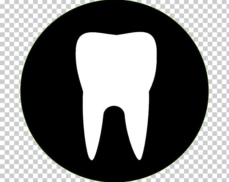 Human Tooth Dentistry PNG, Clipart, Black And White, Circle, Crown, Dental Implant, Dental Restoration Free PNG Download