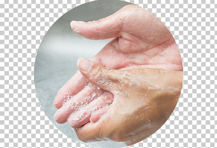 Hand Washing Pinworm Infection Soap Health PNG, Clipart, Finger, Foot, Hand, Handmade Soap, Hand Washing Free PNG Download