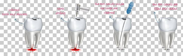 Dental Mint Endodontic Therapy Root Canal Human Tooth PNG, Clipart, Body Jewellery, Body Jewelry, Decayed, Decayed Tooth, Dental Free PNG Download