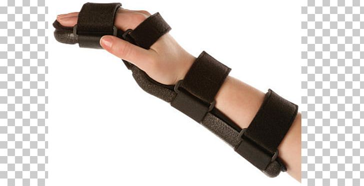 Thumb Splint Wrist Orthotics Hand PNG, Clipart, Arm, Carpal Bones, Digit, Finger, Fizik Free PNG Download