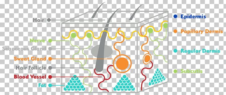 Skin Cancer Basal-cell Carcinoma Stratum Basale PNG, Clipart, Angle, Area, Basalcell Carcinoma, Brand, Cancer Free PNG Download