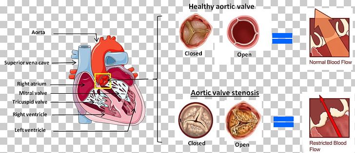 Muscle Heart Homo Sapiens PNG, Clipart, Heart, Homo Sapiens, Human, Muscle, Objects Free PNG Download