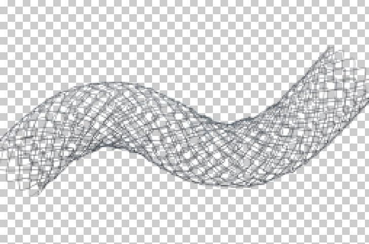 Stenting Self-expandable Metallic Stent Bare-metal Stent Medicine Duodenum PNG, Clipart, Accuracy, Angle, Area, Arm, Baremetal Stent Free PNG Download