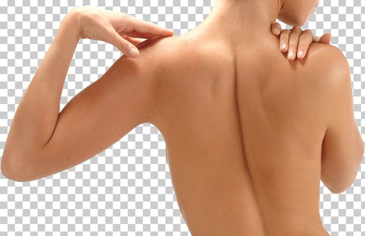 Skin Arm Human Back Shoulder Surgery PNG, Clipart, Abdomen, Active Undergarment, Arm, Back, Back Pain Free PNG Download