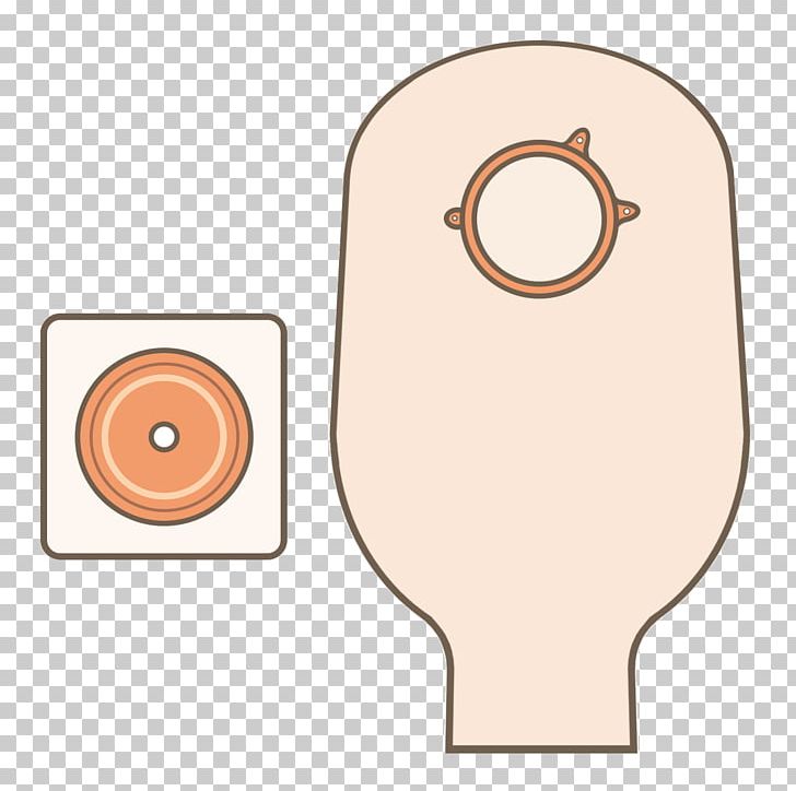 Stoma Ostomy Pouching System Orthotics Health Care Png Clipart Anus