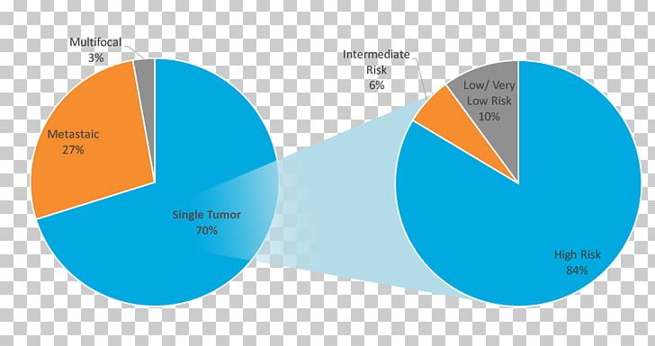 Gastrointestinal Stromal Tumor Chronic Myelogenous Leukemia Cancer Chart February PNG, Clipart, 2017, Bar Chart, Blue, Brand, Cancer Free PNG Download