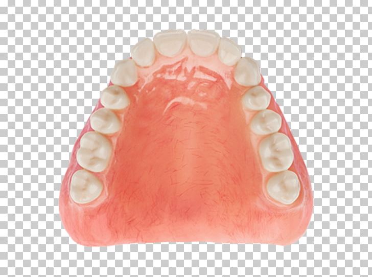 Tooth Dentures Dentistry Diagnostic Wax-up PNG, Clipart, Aspen, Aspen Dental, Auto Detailing, Dental, Dentist Free PNG Download