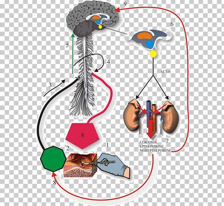 Anesthesia Ache Neuroendocrine Cell Propofol PNG, Clipart, Ache, Analgesic, Anesthesia, Anesthesiology, Angle Free PNG Download