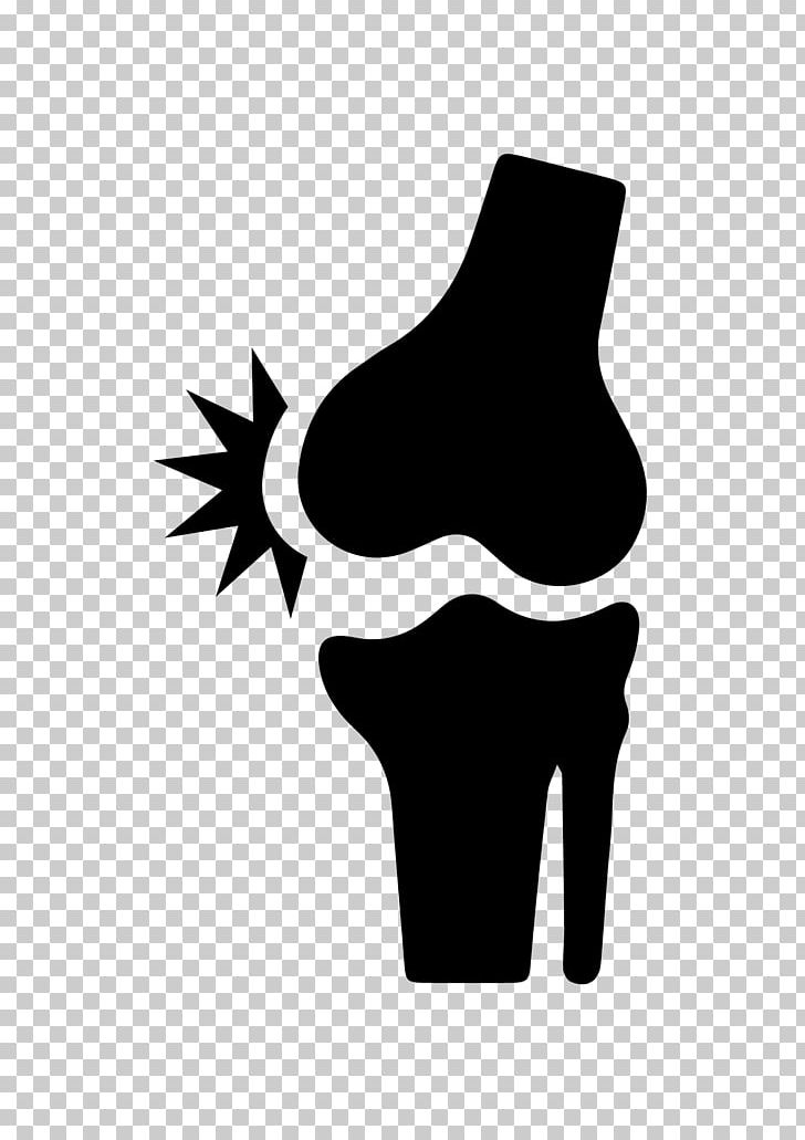Knee Pain Back Pain Joint Pain PNG, Clipart, Arthritis, Back Pain, Black, Black And White, Bone Free PNG Download