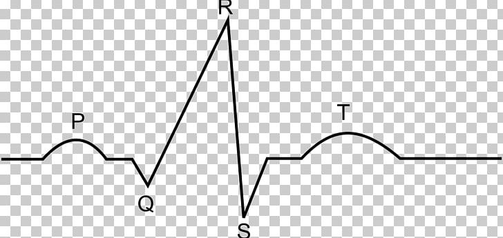 Electrocardiogram Electrocardiography Heart Medicine Drawing PNG, Clipart, Angle, Area, Black And White, Cardiac Cycle, Circle Free PNG Download