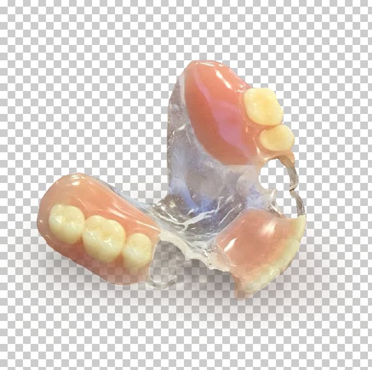 Dentures Tooth Dentistry Manufacturing Dental Impression PNG, Clipart, Dental Impression, Dentistry, Dentures, Electronics, High Tech Free PNG Download