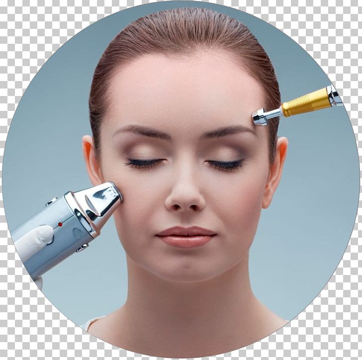 Laser Surgery Skin Photorejuvenation Therapy PNG, Clipart, Acne, Beauty, Cheek, Chin, Clinic Free PNG Download