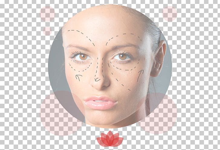 Plastic Surgery Rhytidectomy Wrinkle PNG, Clipart, Beauty, Can Stock Photo, Cheek, Chin, Cosmetics Free PNG Download